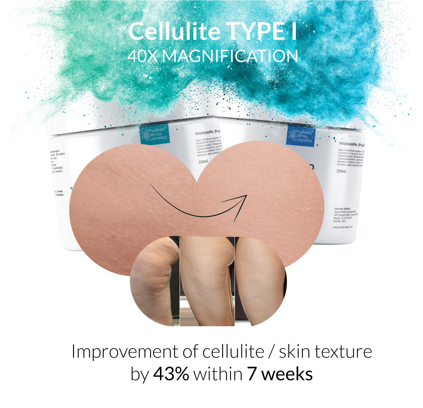 Platz 1 - Anti Cellulite Creme Test: MyNaturalSecret - Pryalesin PROCELL Duo 2 - Anti Cellulite